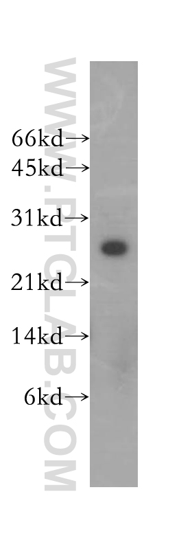 HEBP2 Polyclonal antibody