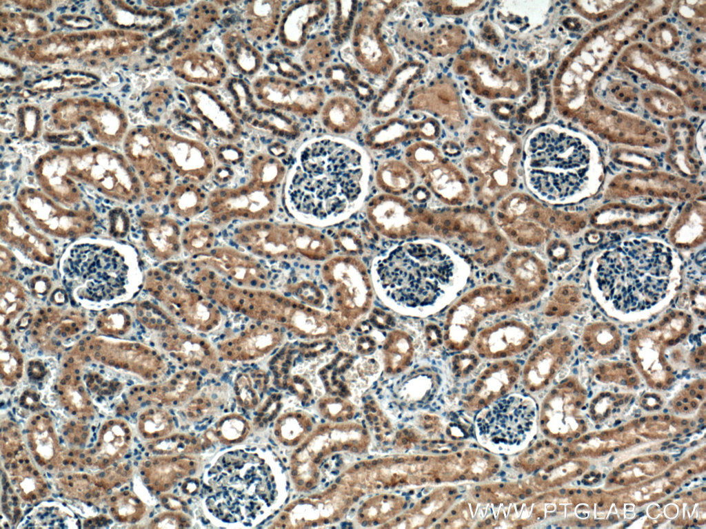 IHC staining of human kidney using 20605-1-AP