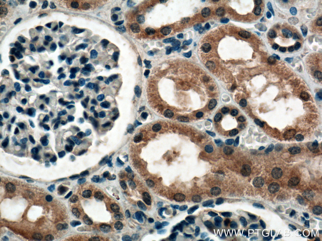 IHC staining of human kidney using 20605-1-AP