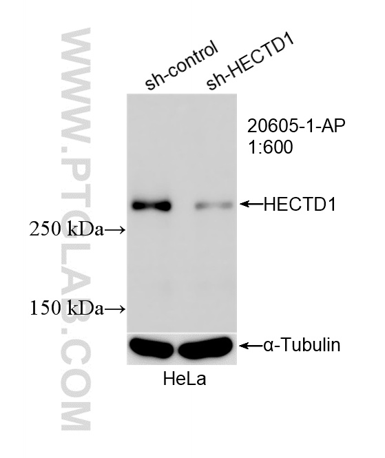 WB analysis of HeLa using 20605-1-AP WB analysis of HeLa using 20605-1-AP
