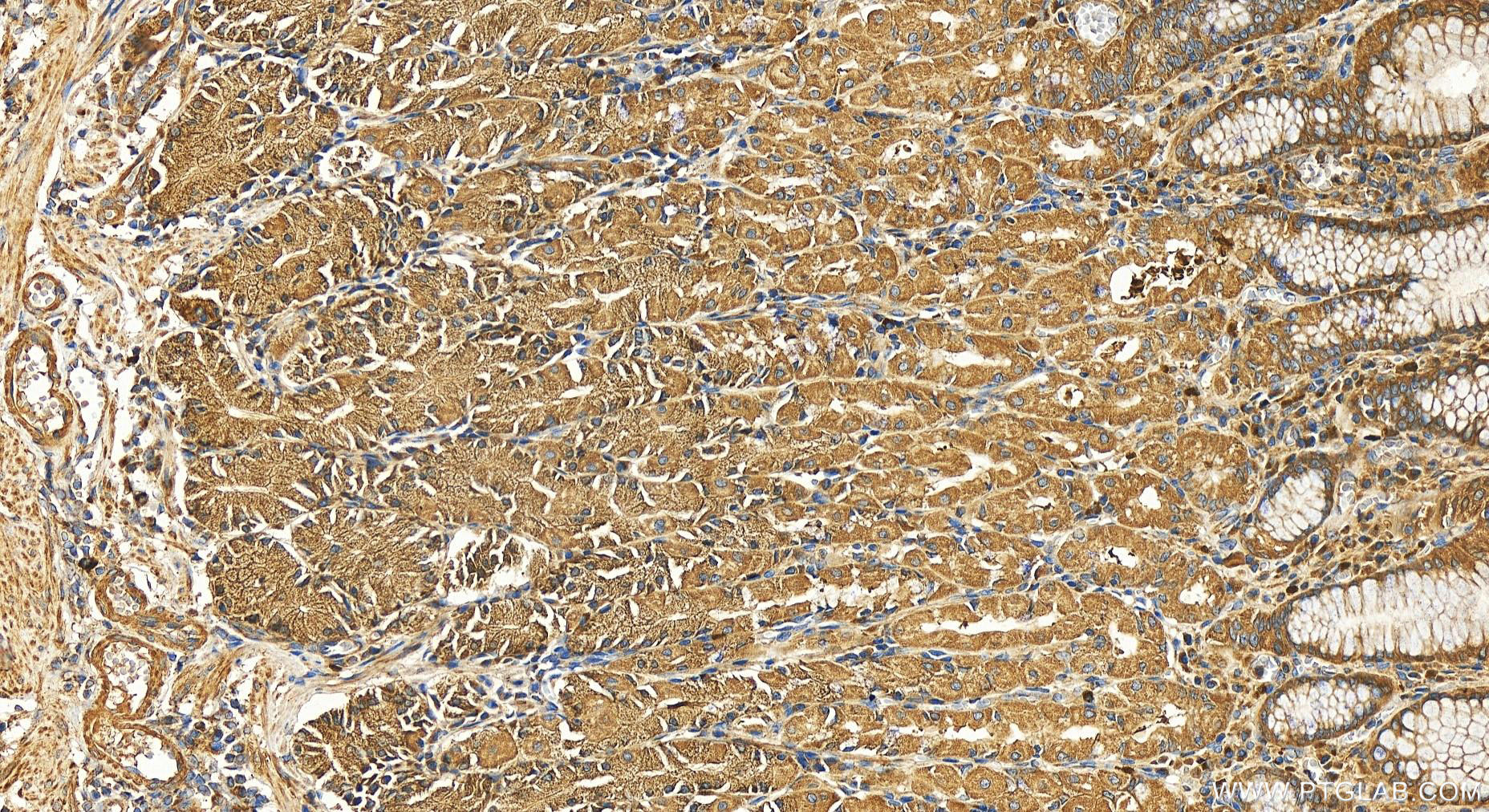IHC staining of human stomach using 11487-1-AP