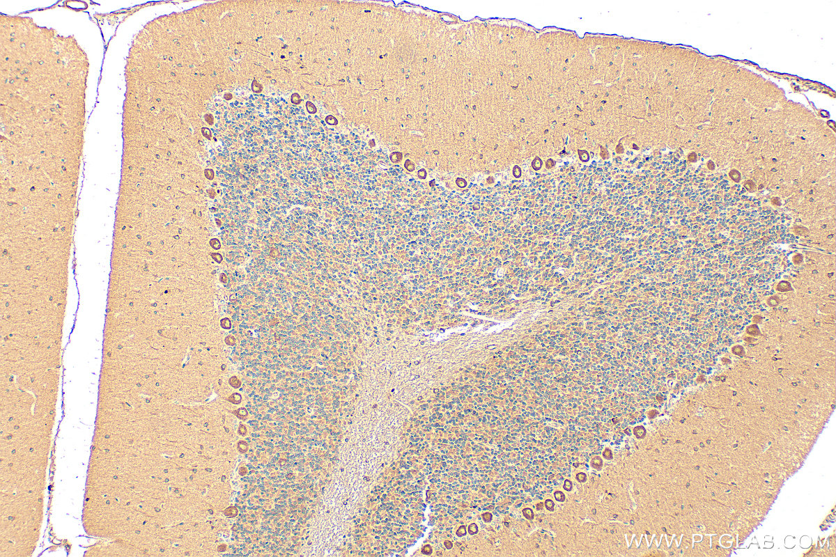 IHC staining of rat cerebellum using 32026-1-AP