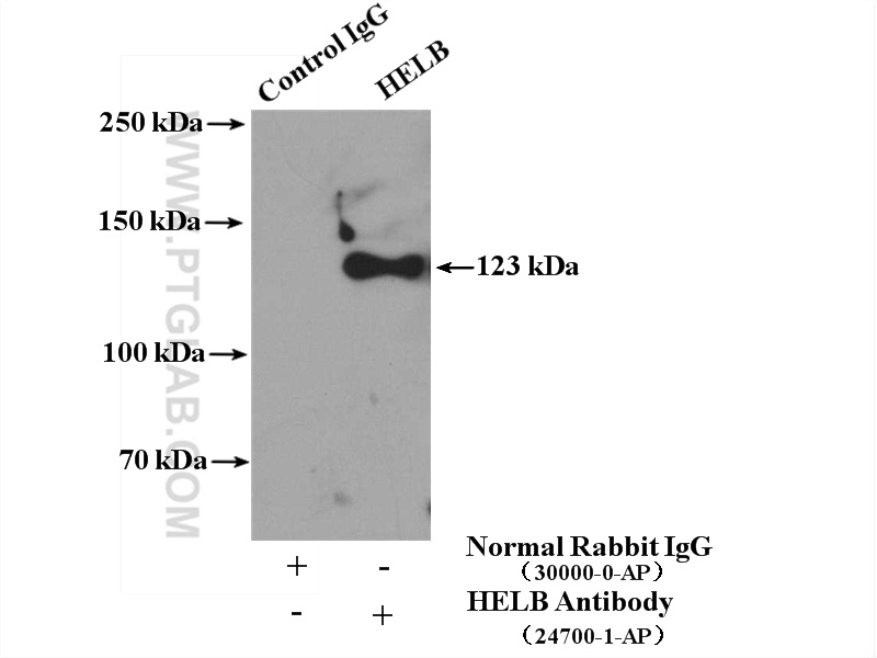 IP experiment of HEK-293 using 24700-1-AP