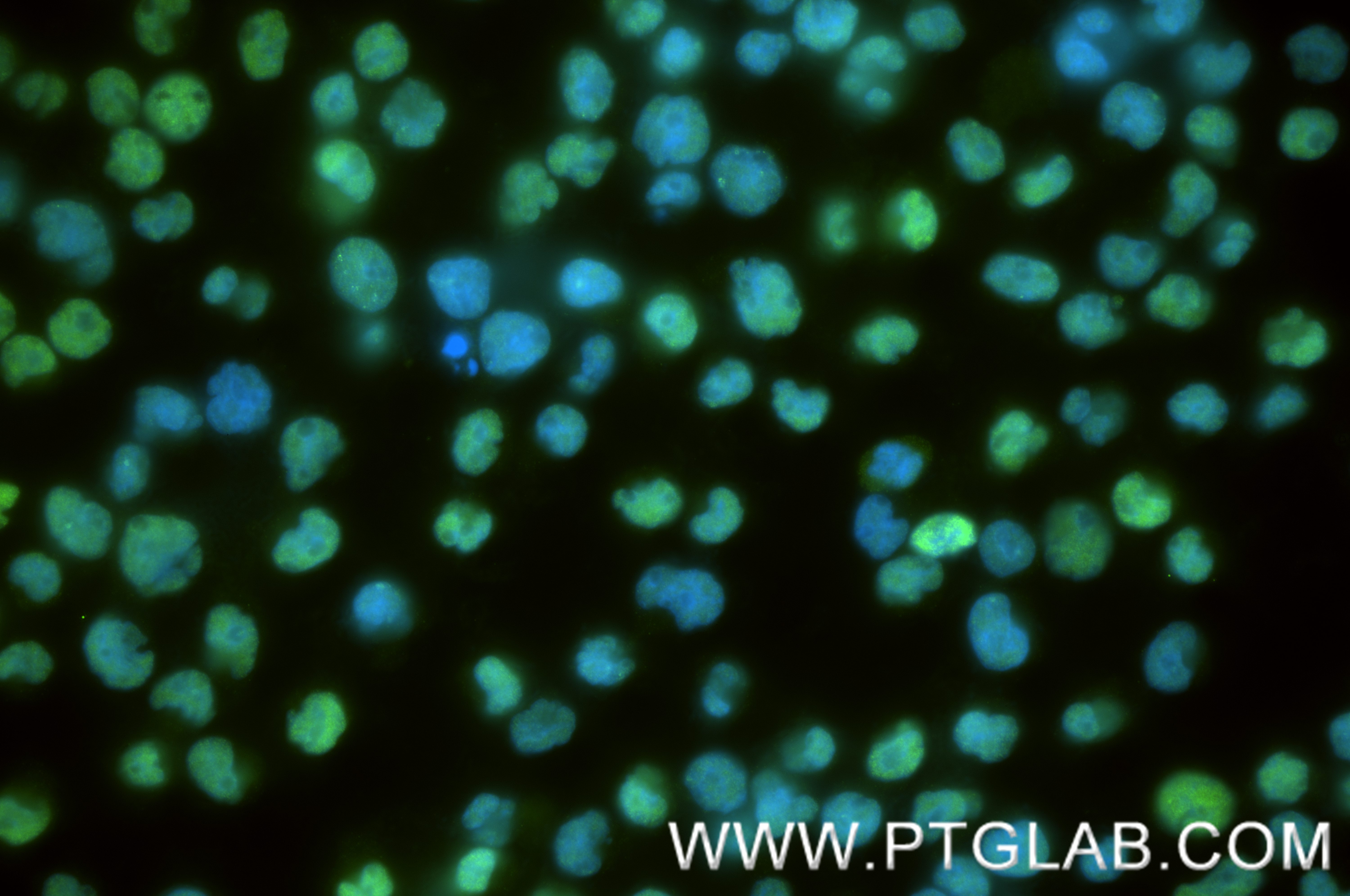 IF Staining of Jurkat using 87876-1-RR IF Staining of Jurkat using 87876-1-RR