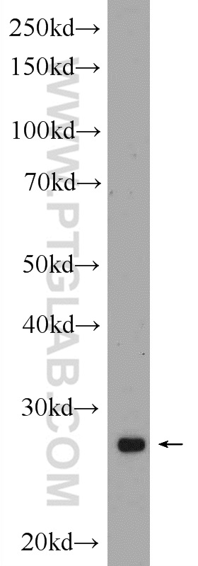 WB analysis of rat heart using 24730-1-AP