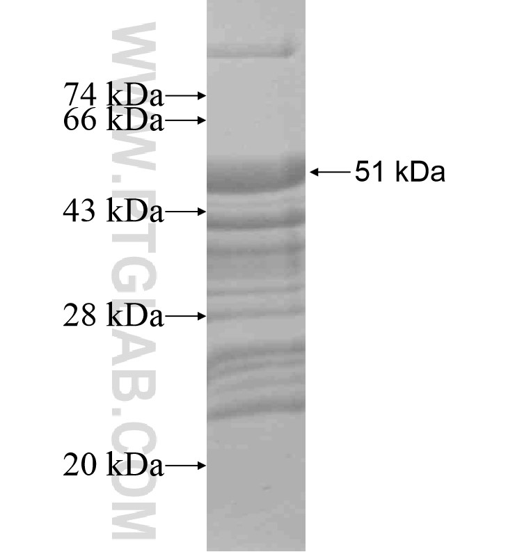 HELT fusion protein Ag16520 SDS-PAGE HELT fusion protein Ag16520 SDS-PAGE