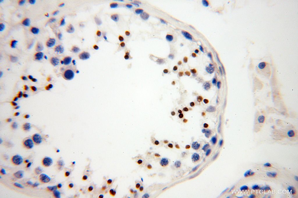 IHC staining of human testis using 17616-1-AP
