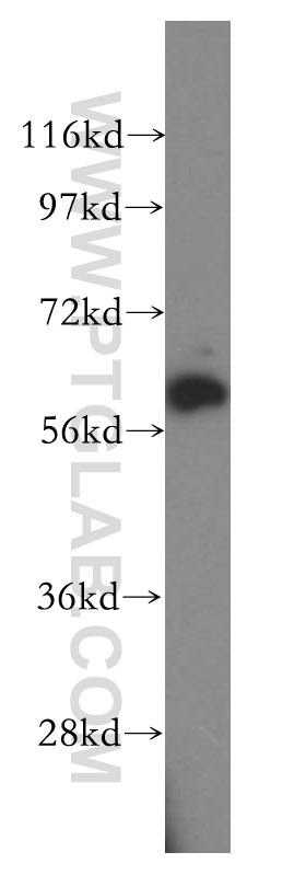WB analysis of Jurkat using 17616-1-AP