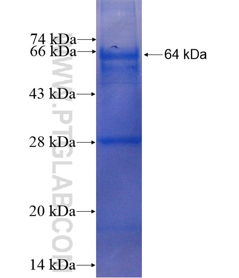 HEMGN fusion protein Ag13193 SDS-PAGE HEMGN fusion protein Ag13193 SDS-PAGE