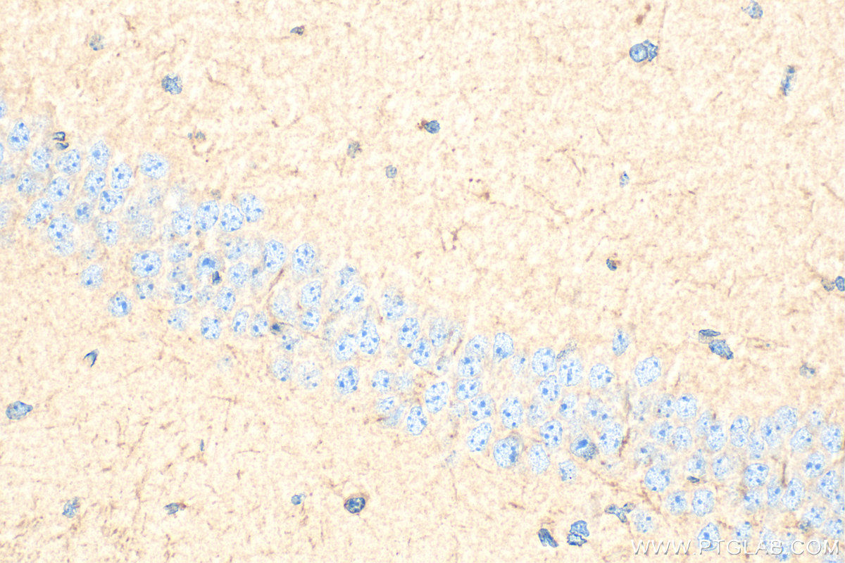 IHC staining of mouse brain using 18177-1-AP
