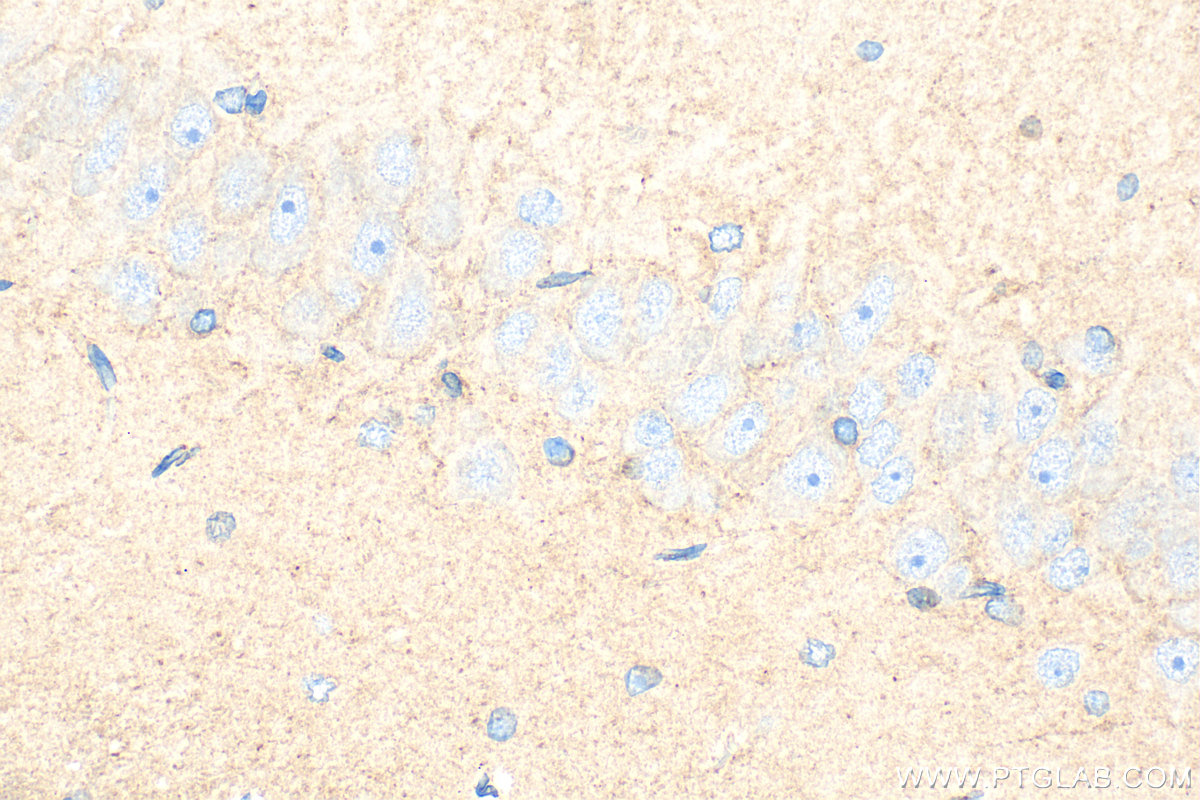 IHC staining of rat brain using 18177-1-AP