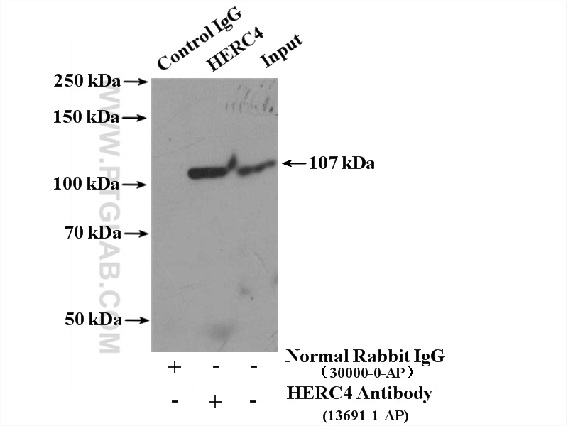 IP experiment of HeLa using 13691-1-AP