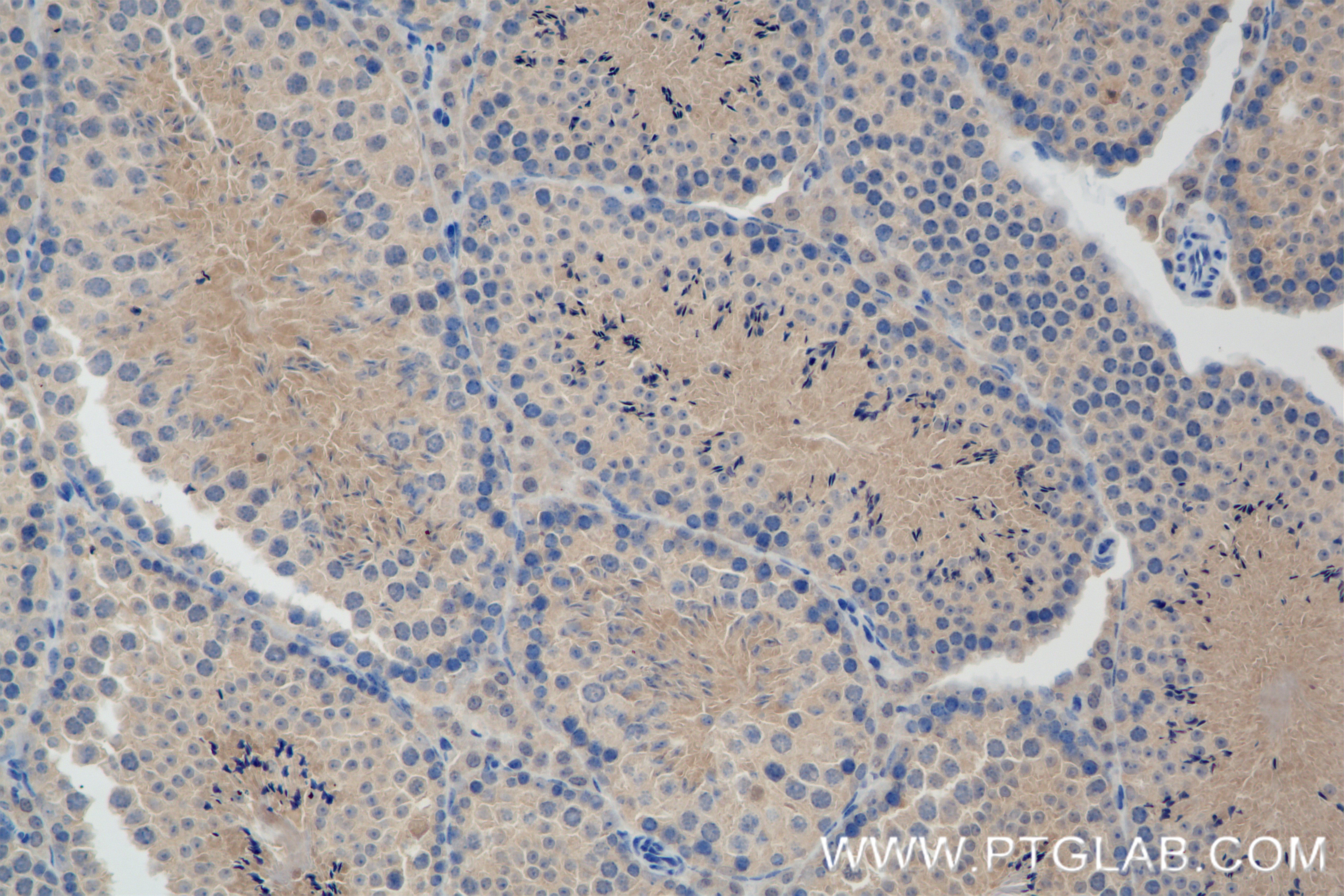 IHC staining of mouse testis using 84952-5-RR (same clone as 84952-5-PBS)