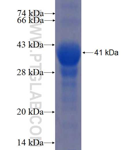 HERC4 fusion protein Ag5302 SDS-PAGE HERC4 fusion protein Ag5302 SDS-PAGE