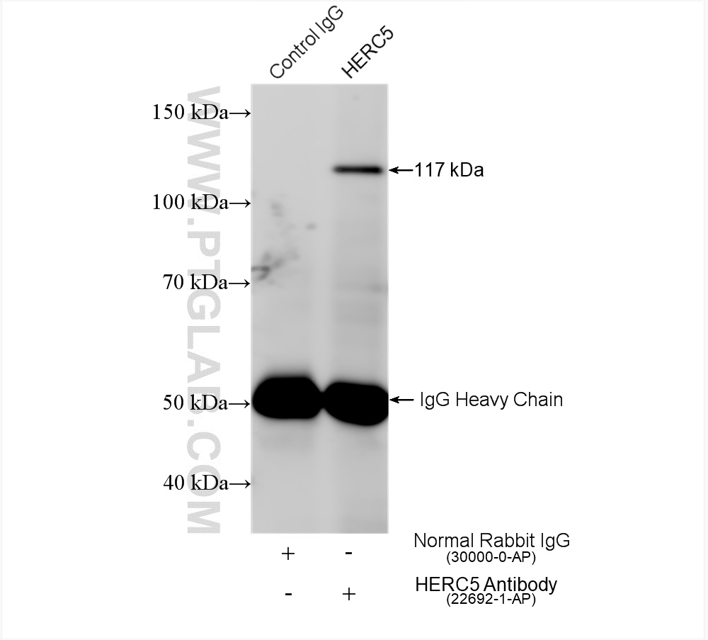 IP result of anti-HERC5 (IP:22692-1-AP, 4ug; Detection:22692-1-AP 1:500) with HEK-293 cells lysate 1400 ug. IP experiment of HEK-293 using 22692-1-AP