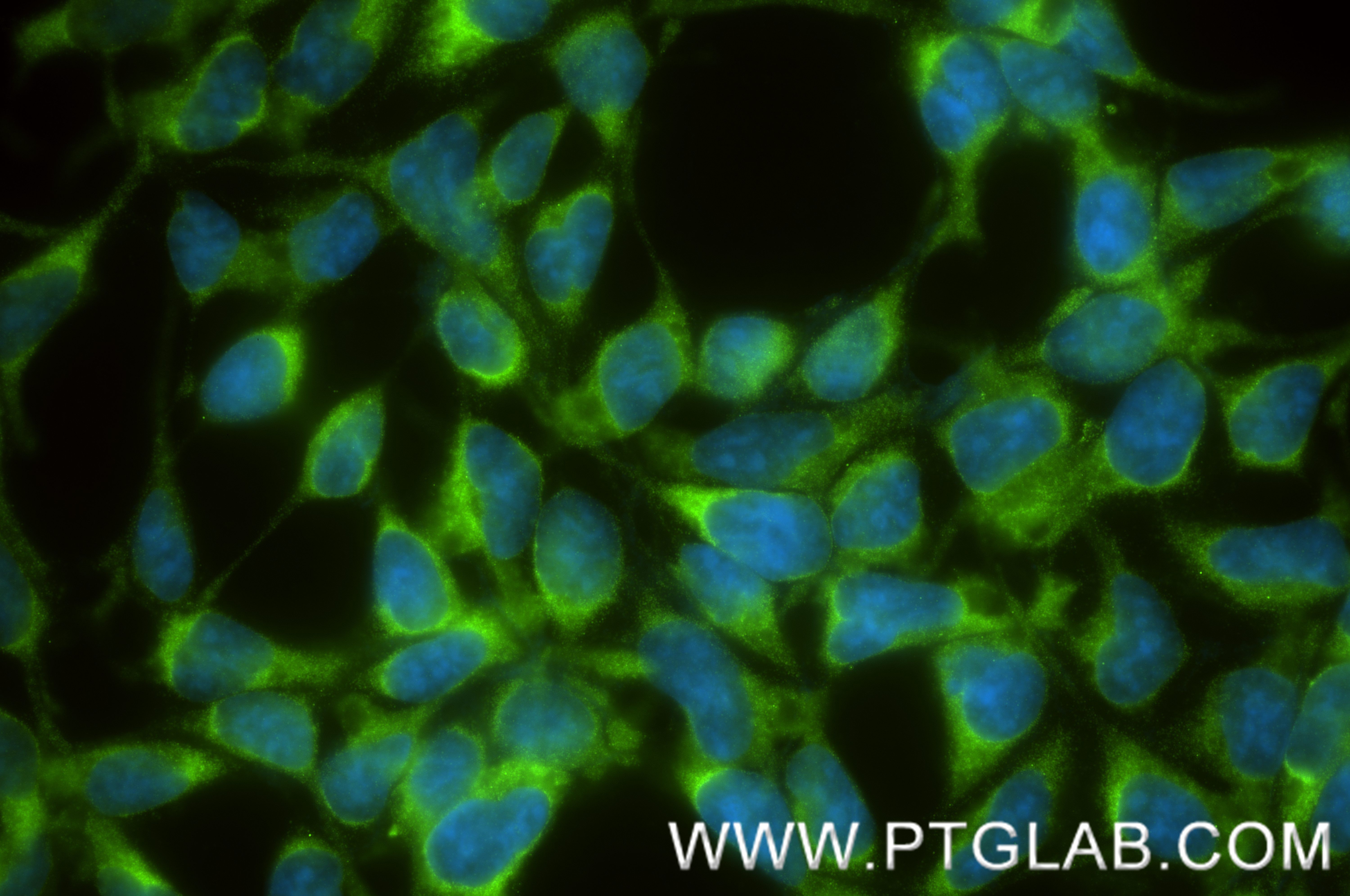 IF Staining of HEK-293 using 87166-1-RR IF Staining of HEK-293 using 87166-1-RR