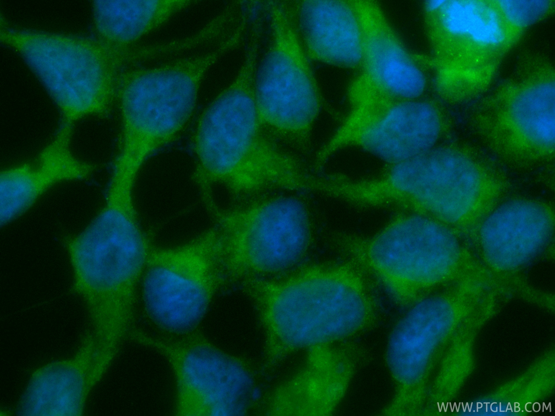 IF Staining of HEK-293 using CL488-87166 IF Staining of HEK-293 using CL488-87166