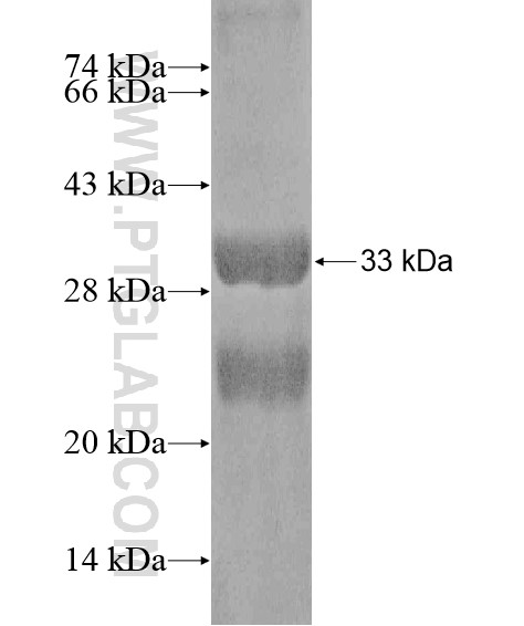 HERC6 fusion protein Ag20302 SDS-PAGE