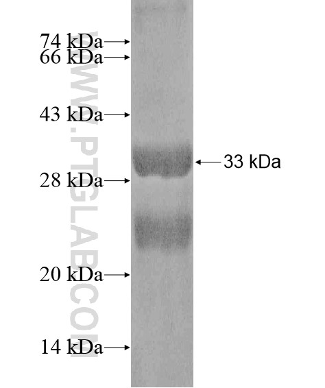 HERC6 fusion protein Ag20302 SDS-PAGE HERC6 fusion protein Ag20302 SDS-PAGE