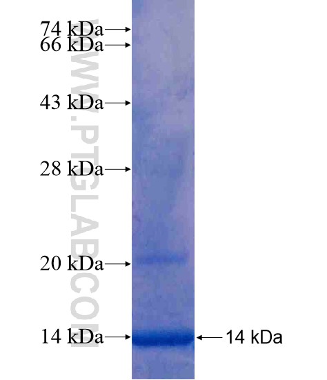 HERC6 fusion protein Ag20403 SDS-PAGE HERC6 fusion protein Ag20403 SDS-PAGE