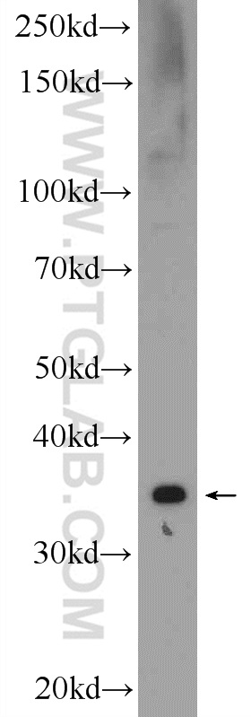 WB analysis of A549 using 20640-1-AP