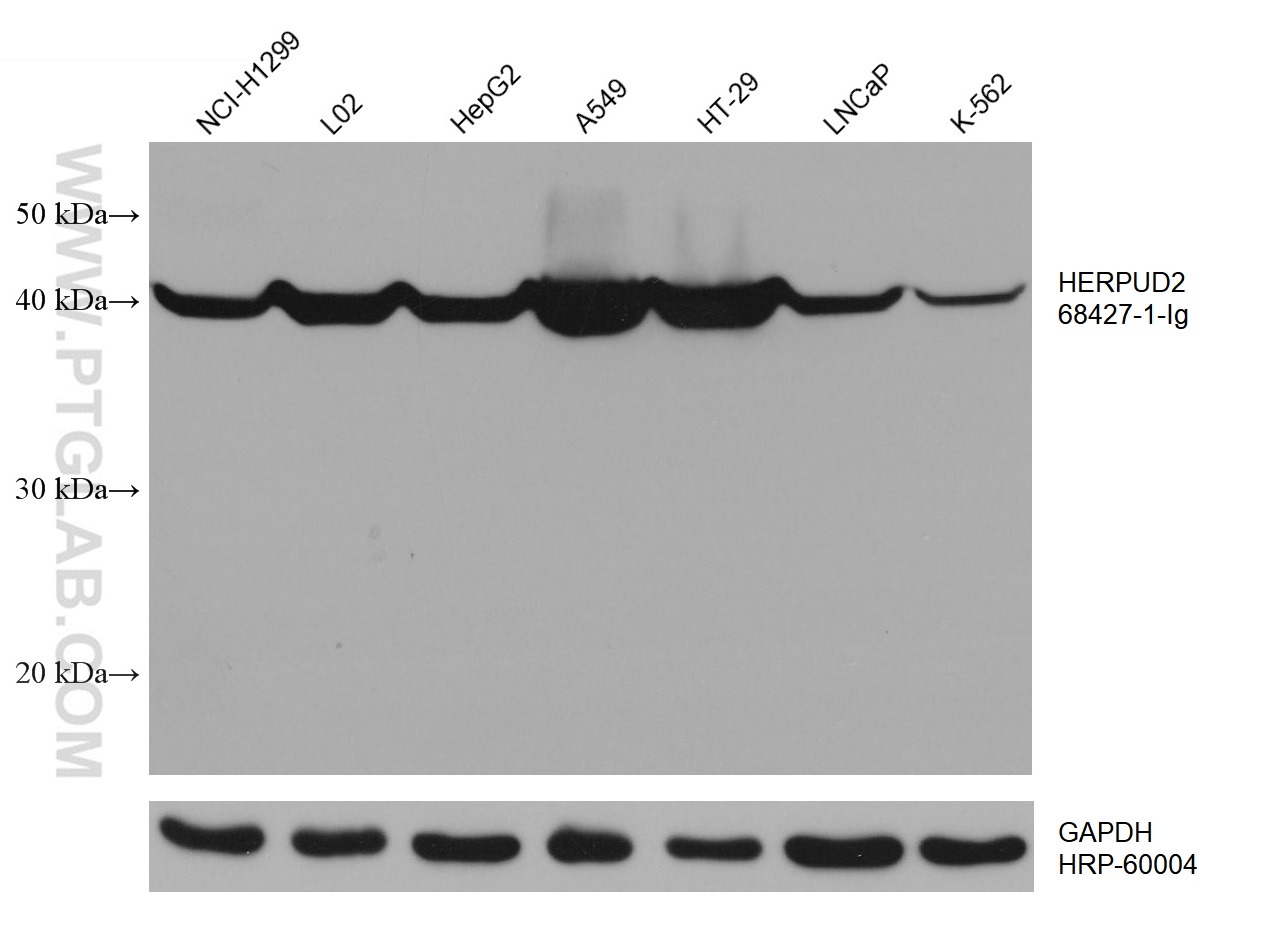 WB analysis using 68427-1-Ig