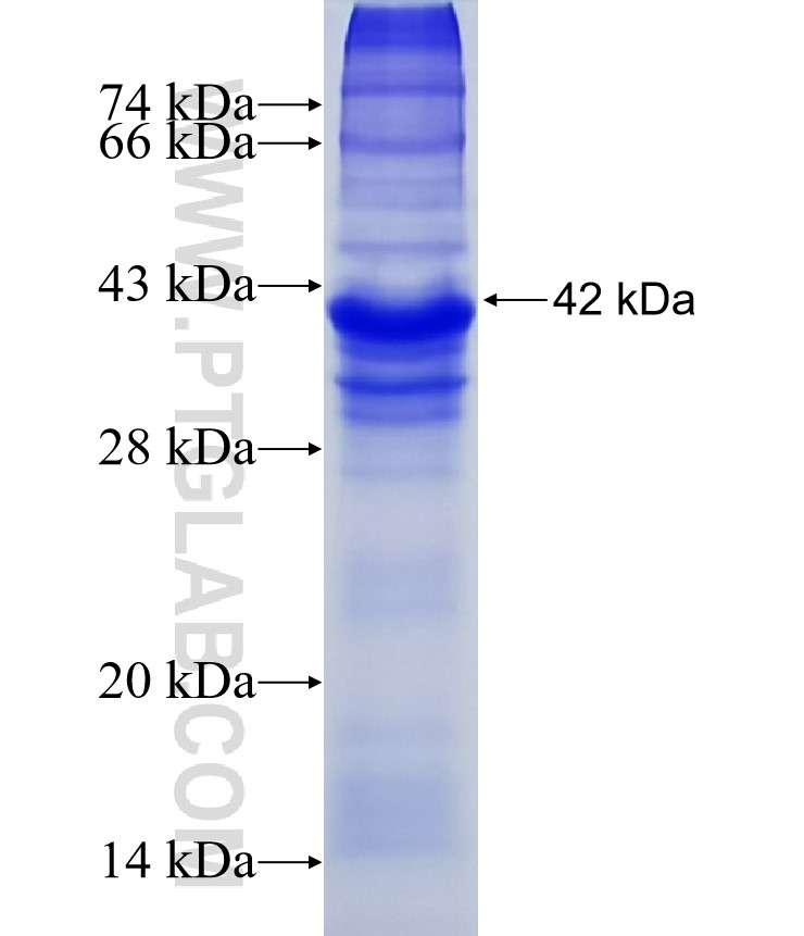 HERV-FRD fusion protein Ag12380 SDS-PAGE HERV-FRD fusion protein Ag12380 SDS-PAGE