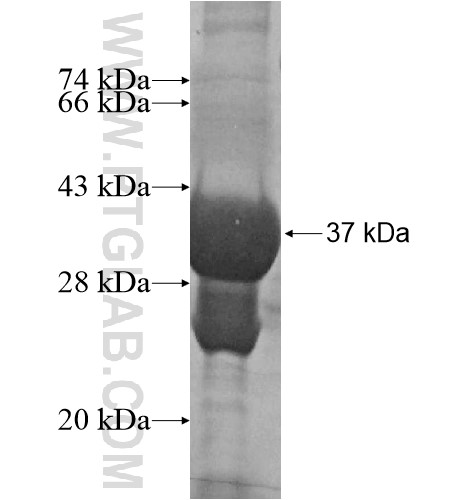 HES2 fusion protein Ag15730 SDS-PAGE HES2 fusion protein Ag15730 SDS-PAGE
