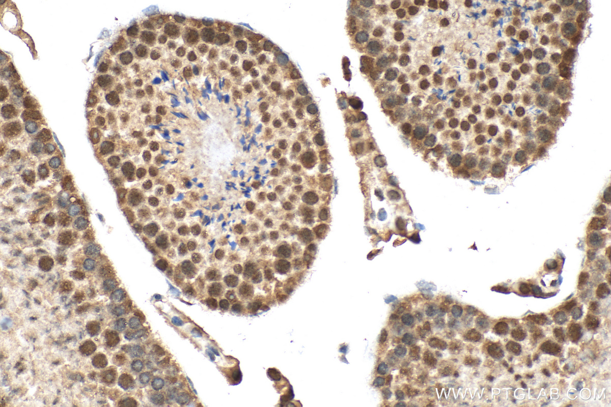 IHC staining of mouse testis using 17927-1-AP