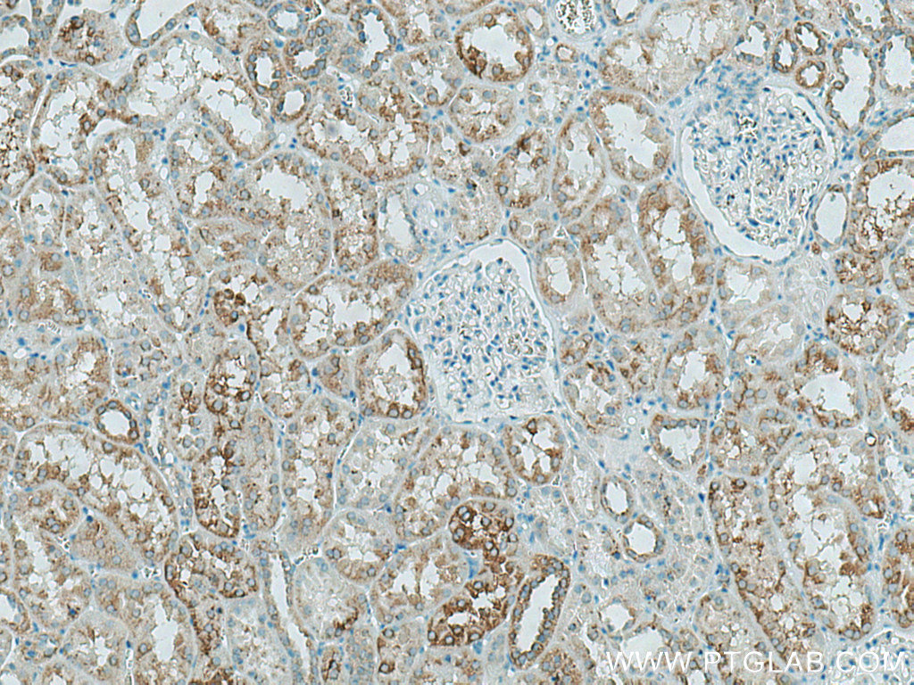 IHC staining of human kidney using 29259-1-AP