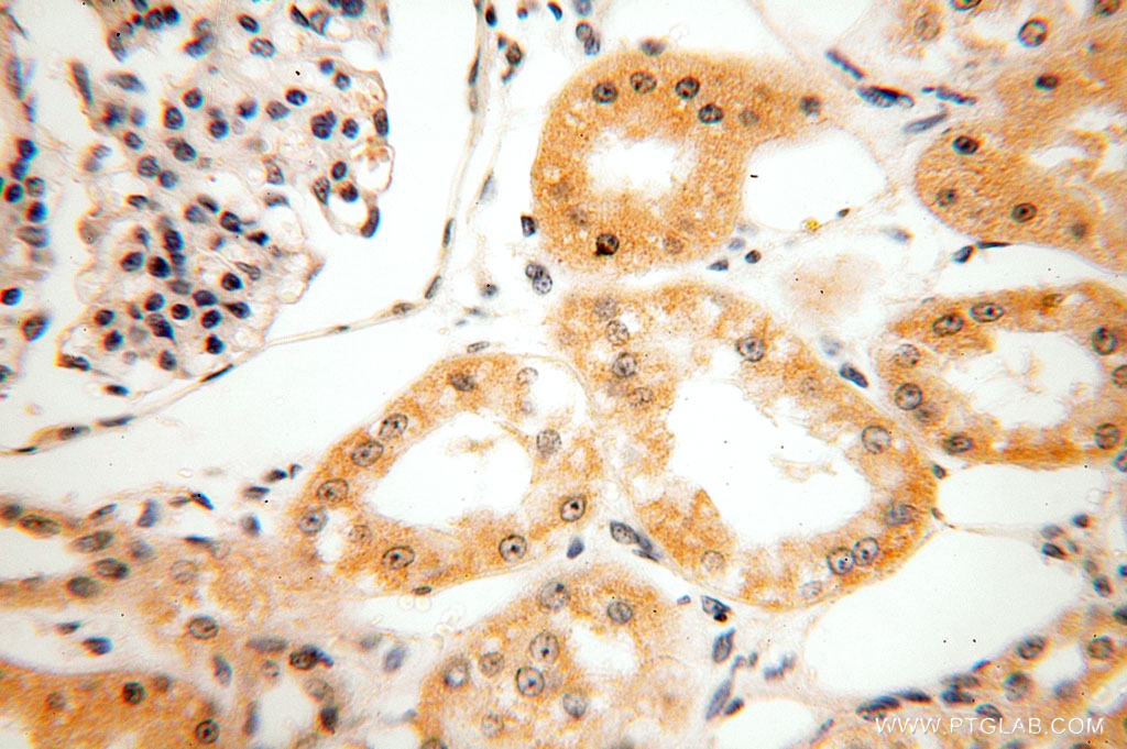 IHC staining of human kidney using 16229-1-AP