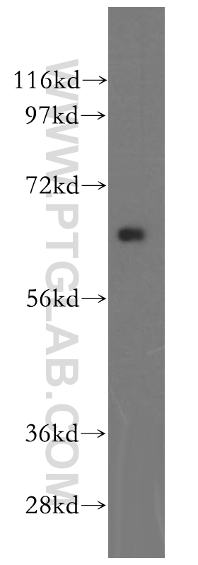 HEXB Polyclonal antibody