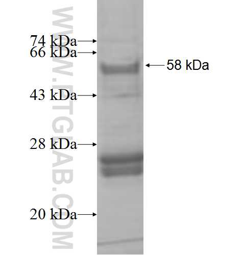 HEXB fusion protein Ag8659 SDS-PAGE HEXB fusion protein Ag8659 SDS-PAGE
