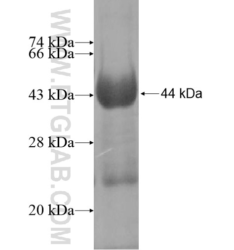 HEXDC fusion protein Ag11466 SDS-PAGE HEXDC fusion protein Ag11466 SDS-PAGE