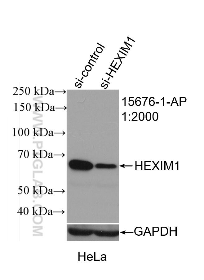 WB analysis of HeLa using 15676-1-AP