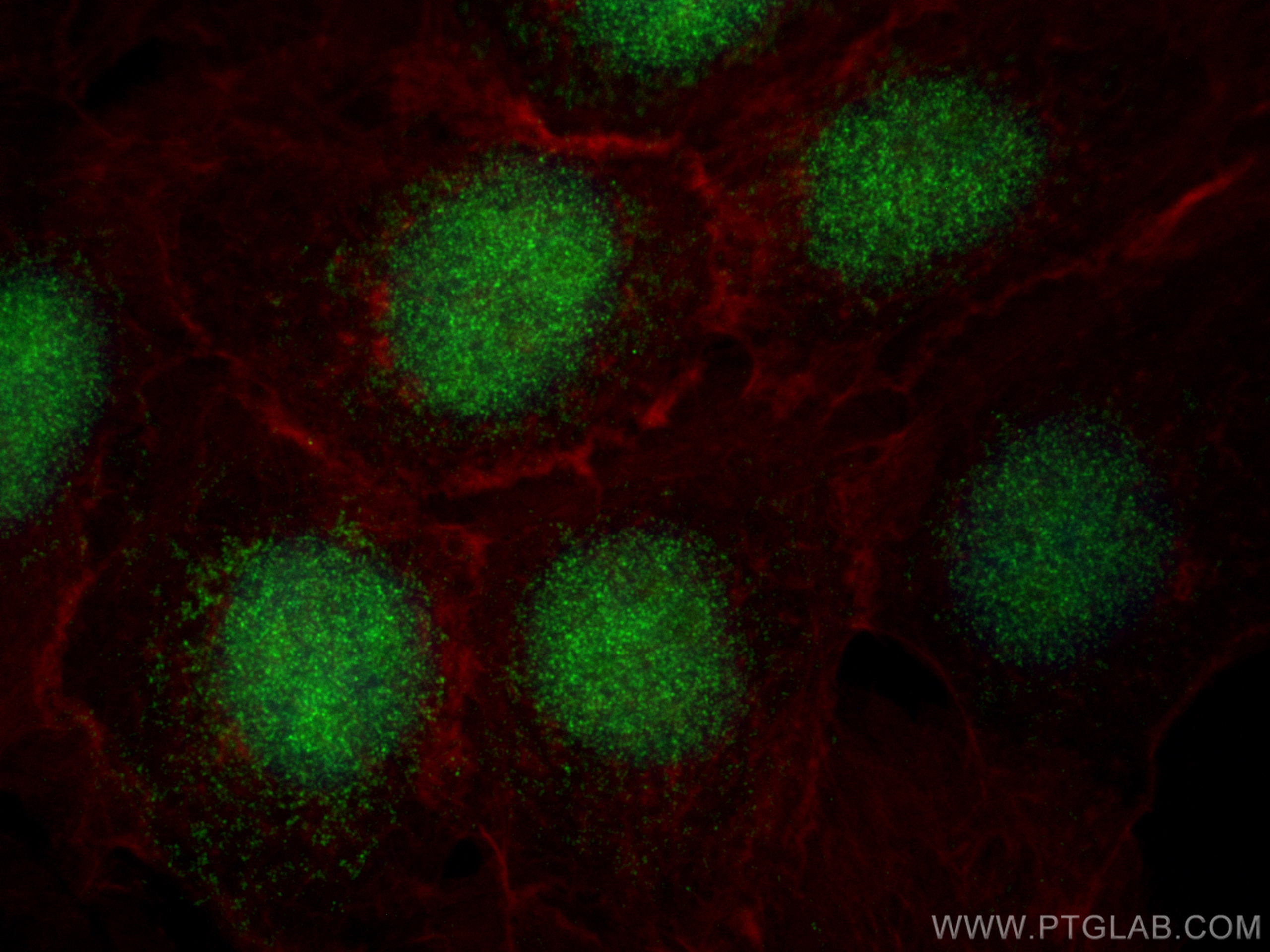 IF Staining of A431 using 16598-1-AP