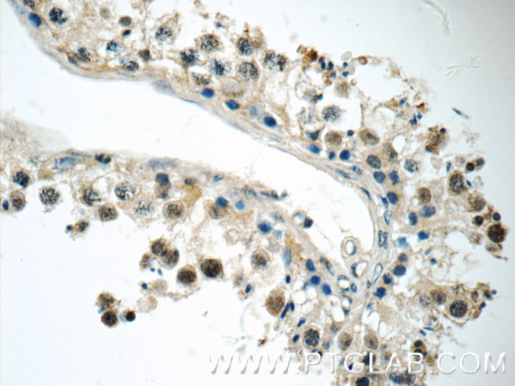 IHC staining of human testis using 16598-1-AP