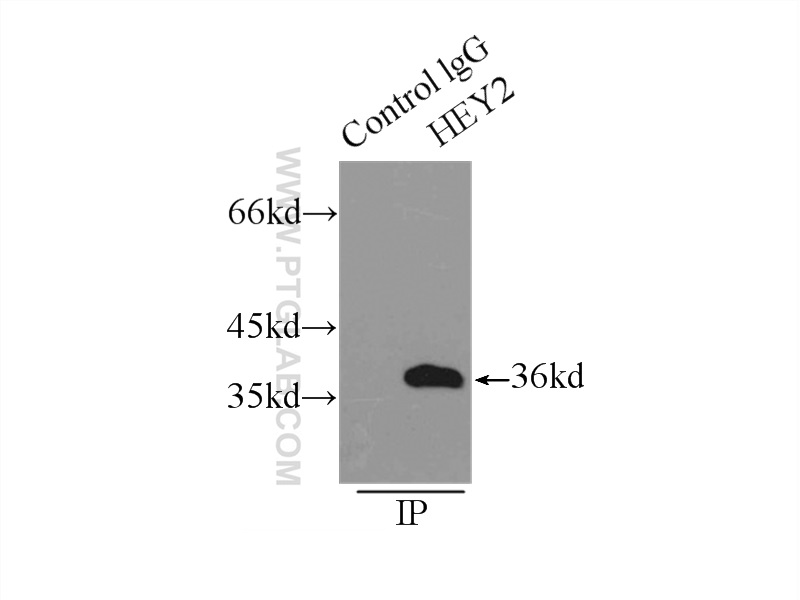 IP experiment of mouse heart using 10597-1-AP