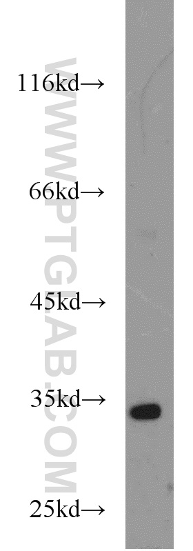 WB analysis of K-562 using 10597-1-AP