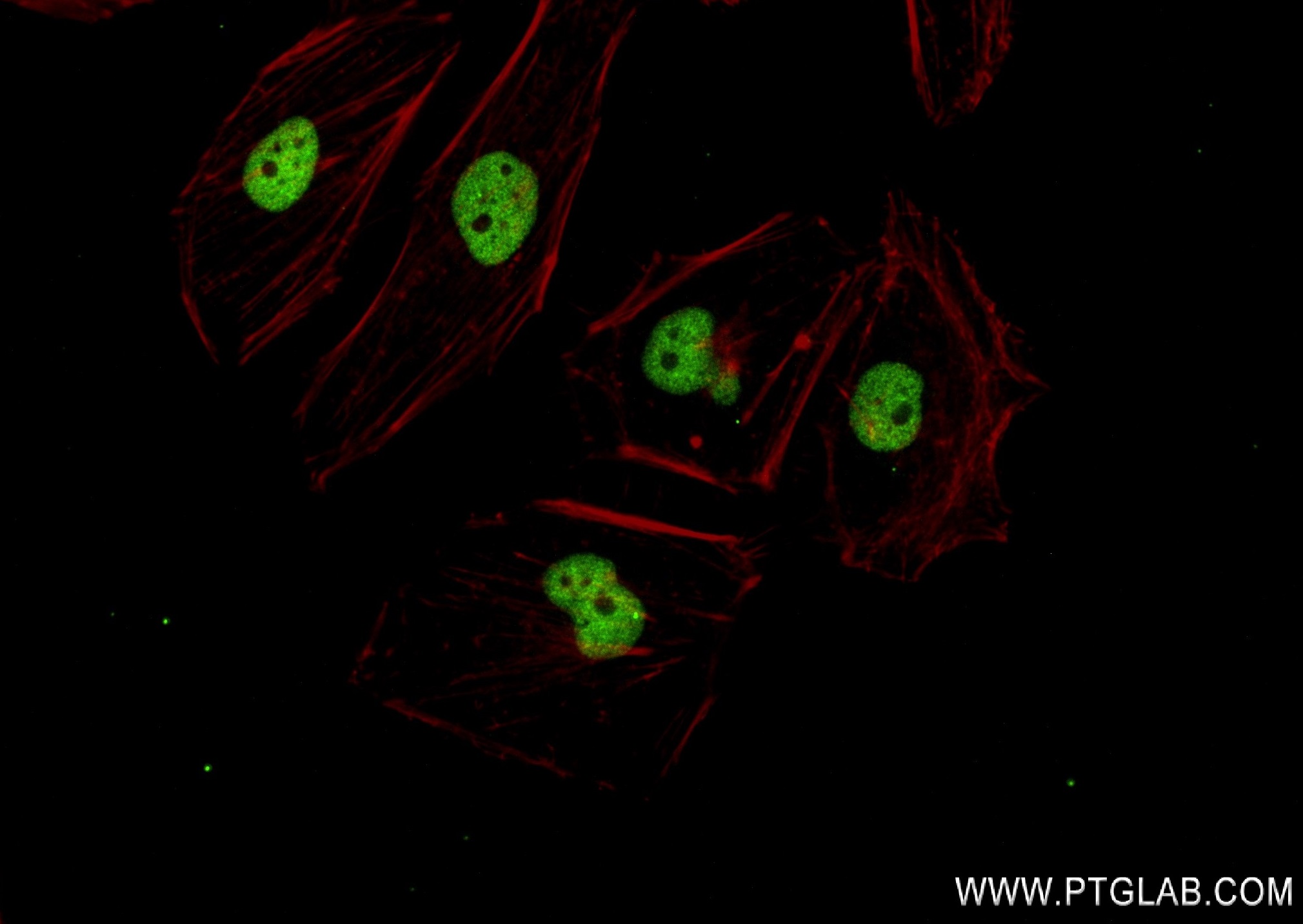 IF Staining of HeLa using 83501-7-RR (same clone as 83501-7-PBS)