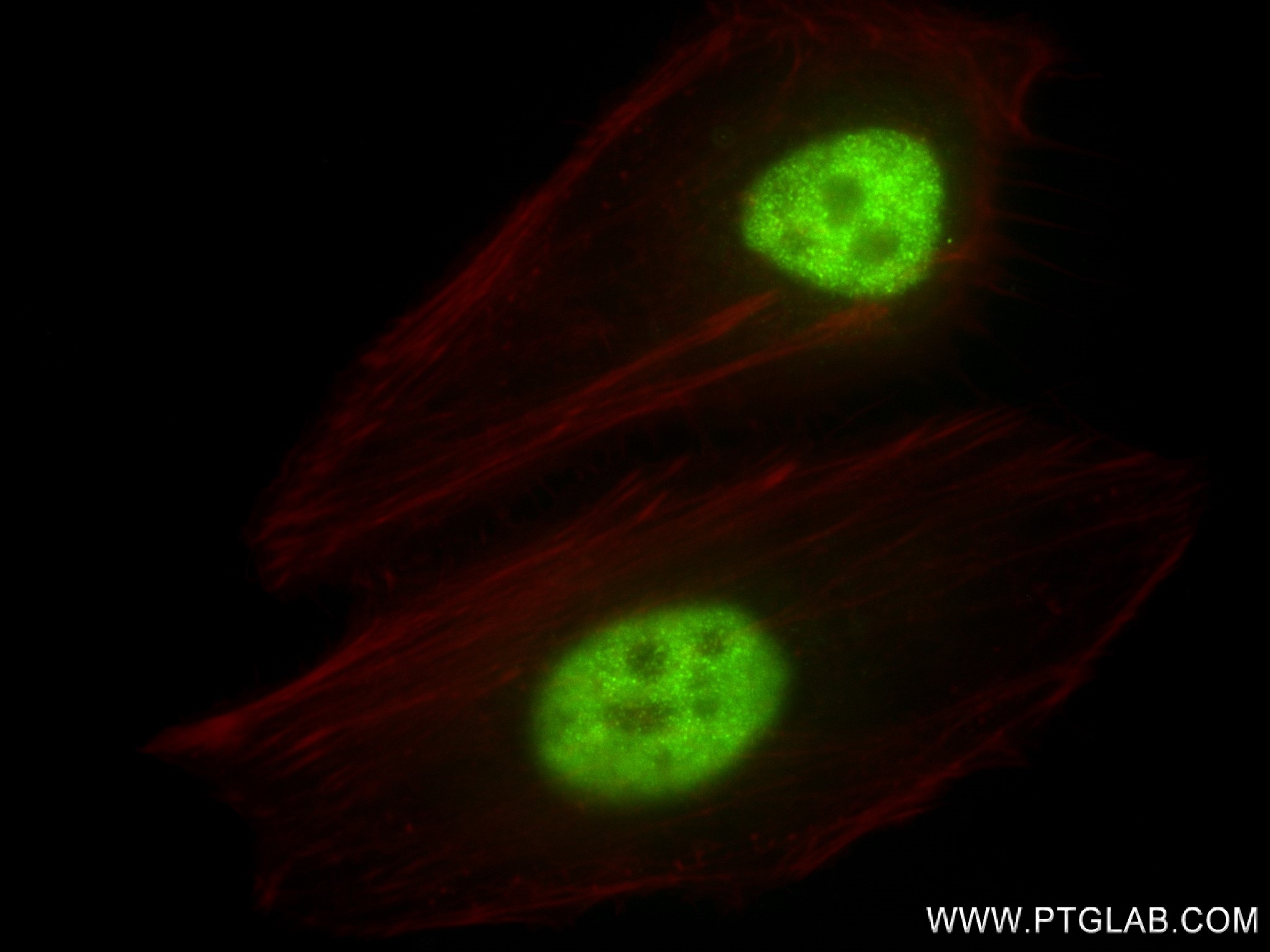 IF Staining of HeLa using 83501-7-RR (same clone as 83501-7-PBS)