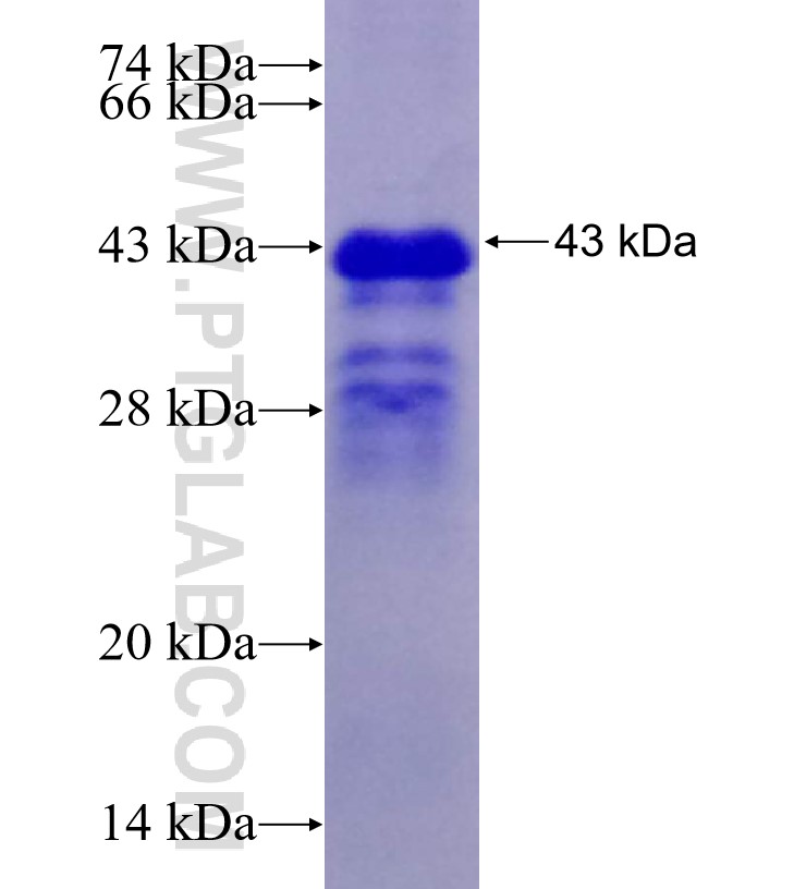 HEY2 fusion protein Ag29280 SDS-PAGE HEY2 fusion protein Ag29280 SDS-PAGE