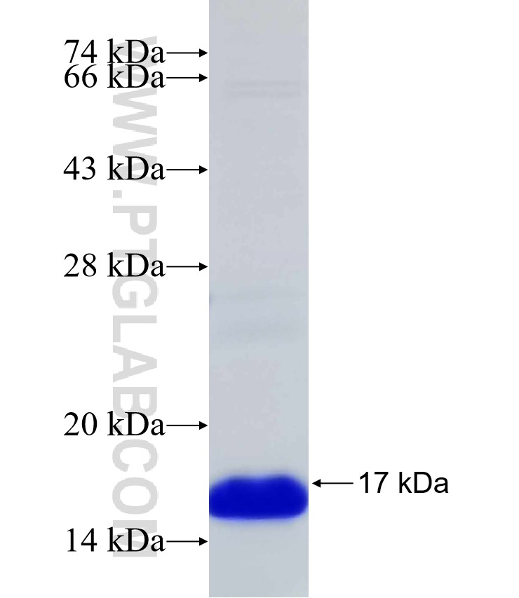 HEY2 fusion protein Ag31307 SDS-PAGE HEY2 fusion protein Ag31307 SDS-PAGE