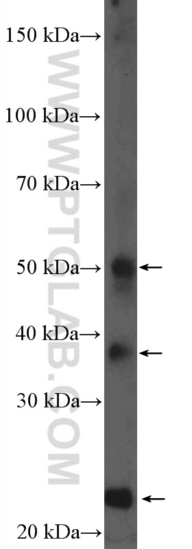 WB analysis of mouse liver using 11758-1-AP