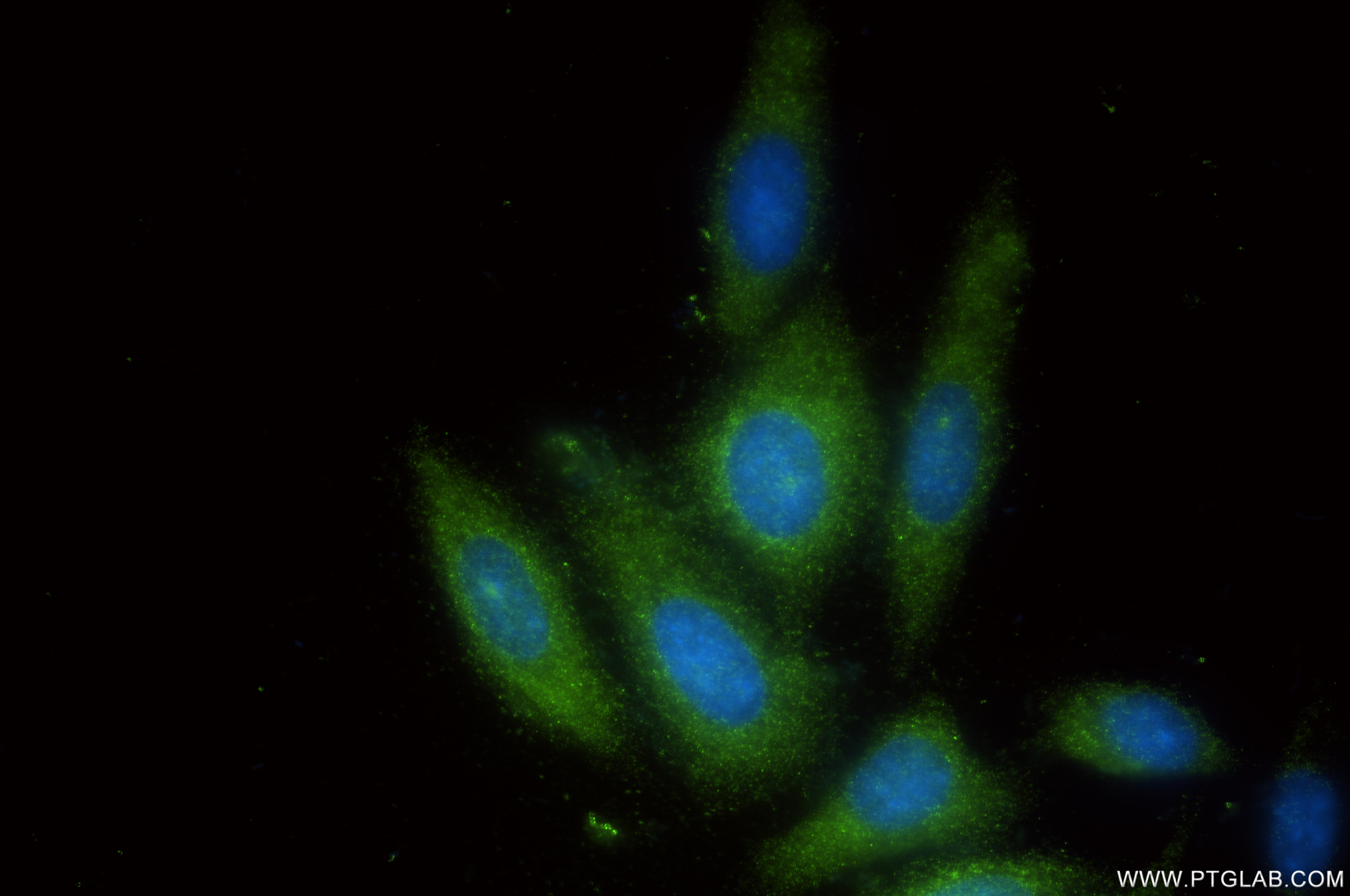 IF Staining of HepG2 using 86775-3-RR