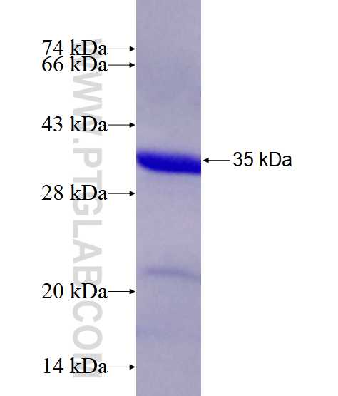 HFM1 fusion protein Ag25862 SDS-PAGE HFM1 fusion protein Ag25862 SDS-PAGE