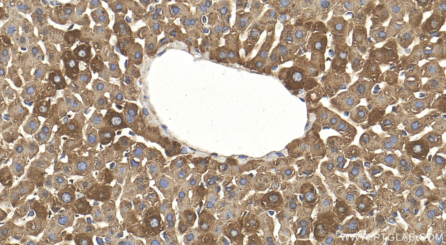 IHC staining of mouse liver using 16465-1-AP