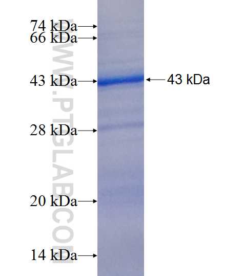 HGD fusion protein Ag9792 SDS-PAGE