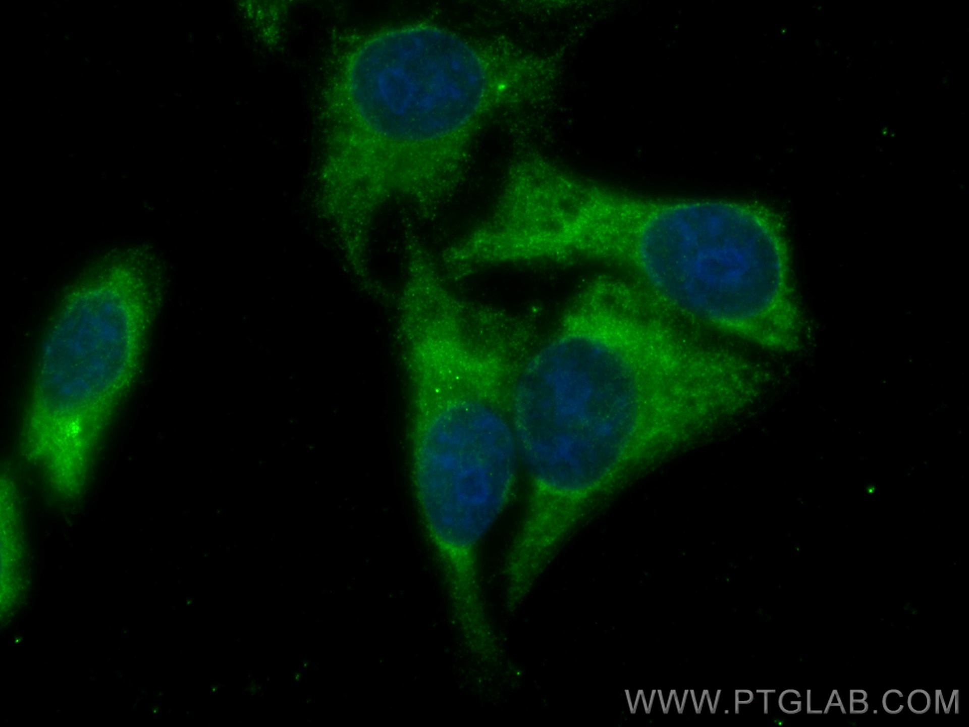 IF Staining of HepG2 using 26881-1-AP