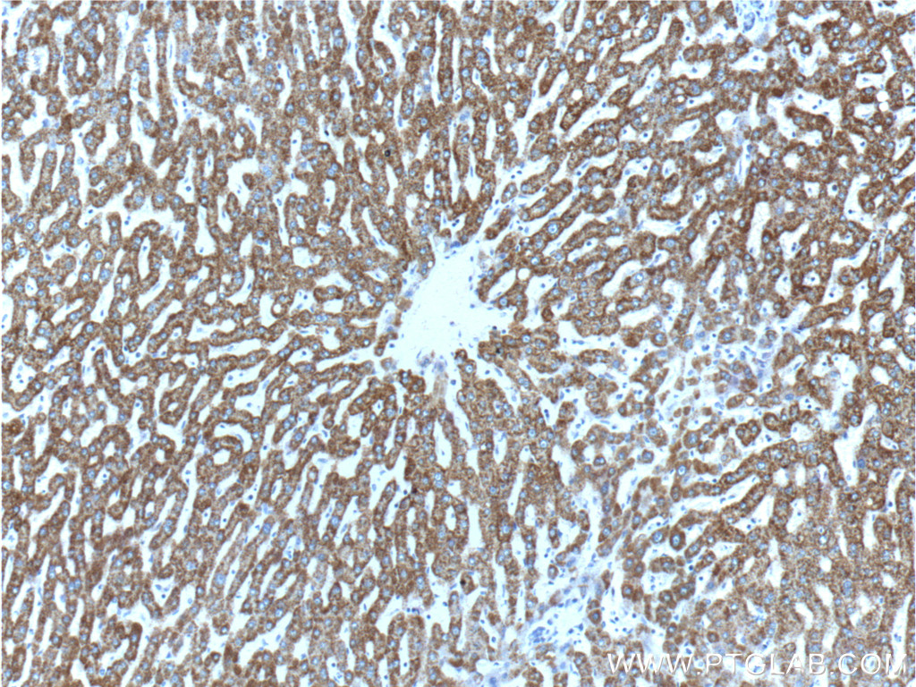 IHC staining of human liver using 10390-1-AP